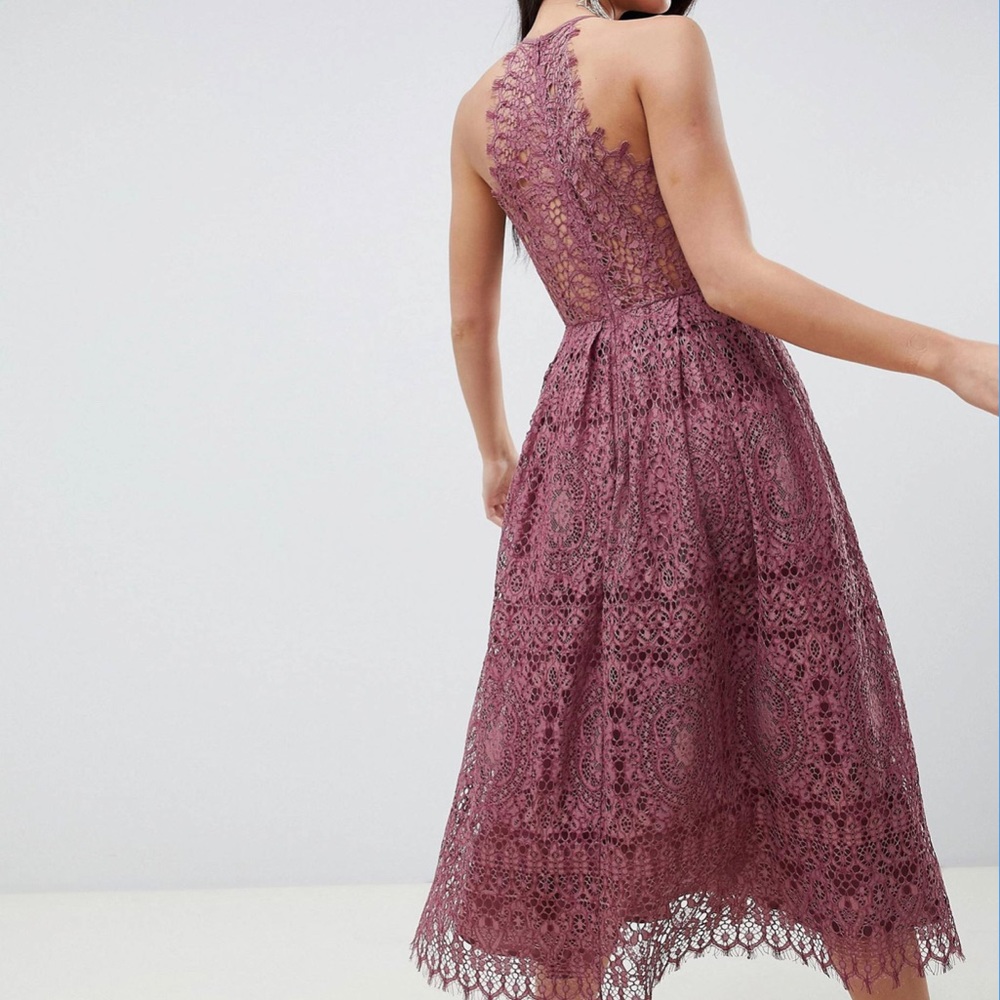 ASOS DESIGN lace pinny scallop edge midi dress - Picture 5 of 12
